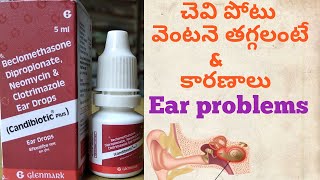 How To Use Ear Drops Techniques Tips and Recommendations [upl. by Hsima398]