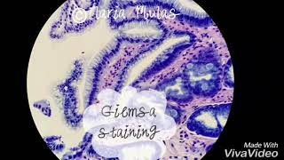 Giemsa staining of stomach biopsy [upl. by Sakram]