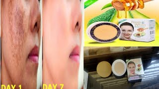 fresh amp white beauty cream result use price side effects Hindi review [upl. by Anertac]