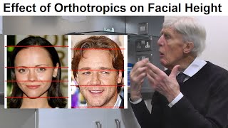 Is Orthotropics Treatment Able to Affect the Length of the Face by Prof John Mew [upl. by Einot49]