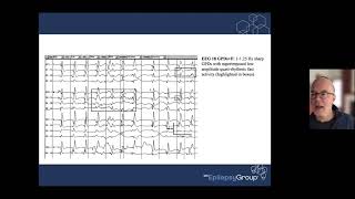 ICTAL INTERICTAL CONTINUUM 20211110 132939 Meeting Recording 1 [upl. by Losyram]