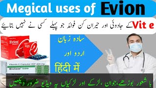 Evion 400mg for skin kese use karen  evion 400 khane ke fayde benefits and uses vitamin e capsule [upl. by Anahsirk]