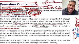 Cardiac Arrhythmias and Their Electrocardiographic Interpretation  part 2 [upl. by Nulubez]