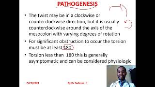 Volvulussigmoidcecaltransverse colonsplenic flexture part I by dr Tadesse fenta [upl. by Teirrah]