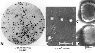 The Smallpox Virus  Biological Weapon or Research Tool [upl. by Normi]