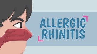 What is Allergic Rhinitis [upl. by Eikcir]