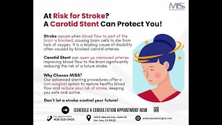 Reduce Stroke Risk with Carotid Stenting [upl. by Amles]