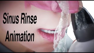 Sinus Rinse Animation [upl. by Comyns201]