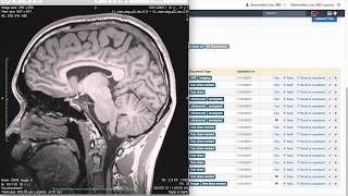 Training DrChrono Charts and Clinical Notes  Patient Documents [upl. by Atig]