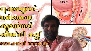 Prostate  Uterus Cancer  Kidney Stone  Kidney Cleaning Medicine  Mohanan Vaidyar  Malayalam [upl. by Crescentia]