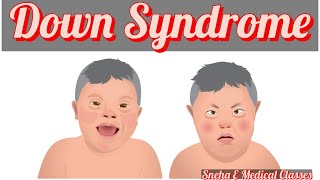 Down Syndrome  Genetics  Hindi [upl. by Craner]