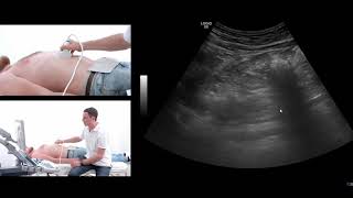 How to perform an ultrasound exam of the pancreas [upl. by Aitas]