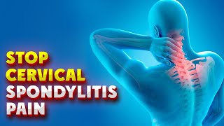 5 Cervical Spondylitis Exercises for Quick Relief [upl. by Akehs119]