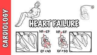 Heart failure with reduced and preserved ejection fraction pathophysiology and treatment [upl. by Howlyn675]