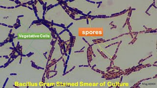 Spore staining and Microscopy at 1000X2000X and 4000X Magnifications [upl. by Valeta]