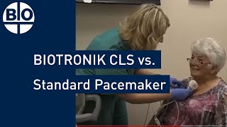 Comparing Heart Rate Regulation BIOTRONIK CLS vs Standard Pacemaker [upl. by Rodolphe]