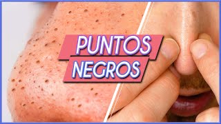 CÓMO ELIMINAR LOS PUNTOS NEGROS [upl. by Asile]