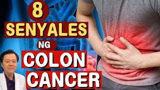 8 Senyales ng Colon Cancer  Payo ni Doc Willie Ong Internist and Cardiologist [upl. by Doloritas968]