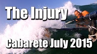 The Injury  Windsurfing Cabarete July 2015 [upl. by Renraw]