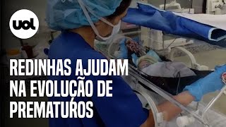 Hospitais usam redinhas que auxiliam na evolução de prematuros [upl. by Peppie259]