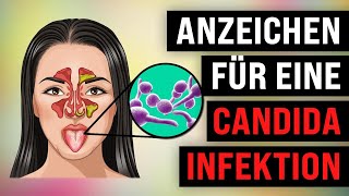 10 Symptome für eine CandidaÜberwucherung Pilzinfektion [upl. by Clements13]