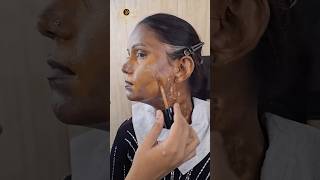 GLAM LOOK TAUGHT ON DEEP VITILIGO SKIN [upl. by Anyzratak125]