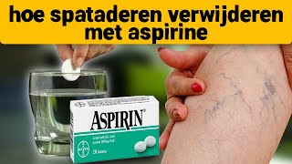 Spataderen verdwenen op de 7e dag neem aspirine en [upl. by Hussar]