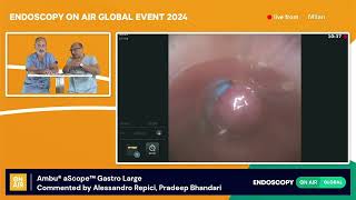 1  Ambu® aScope™ Gastro Largemp4 [upl. by Name654]