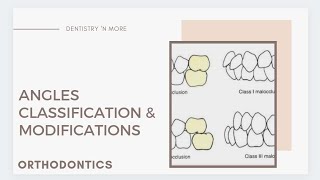 ANGLES CLASSIFICATION ampMODIFICATIONS [upl. by Nauht299]