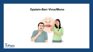 EpsteinBarr VirusMono [upl. by Bancroft]