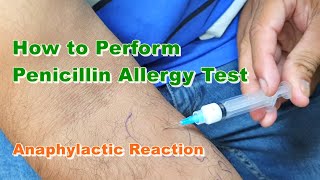 Penicillin G Allergy Test  Benzylpenicillin  Type 1 Hypersensitivity Reaction  How to Do [upl. by Roswald]