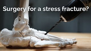 Stress Fracture Surgery What You Need to Know [upl. by Sandberg]