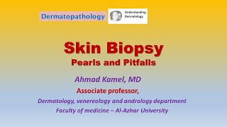 Skin Biopsy Pearls and Pitfalls [upl. by Voss]