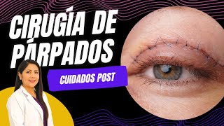 Cuidados Después De Tu Blefaroplastia 👁️ Post Quirúrgico Cirugía de Párpados ❤️ Dra Lizbeth Zuñiga [upl. by Aniar341]