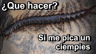 ¿que debo hacer si me pica un ciempies [upl. by Drahsir120]