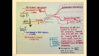 Postrenal Failure  CRASH Medical Review Series [upl. by Atinrahs579]