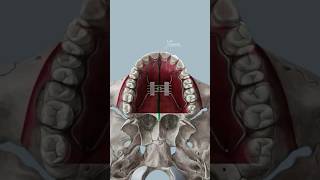 Los expansores del paladar y su impacto en el rostro PARTE 1 [upl. by Mears]
