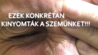 Ezek Konkrétan KINYOMTÁK A SZEMÜNKET [upl. by Rutherford795]