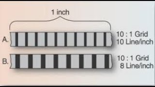 Lecture  Radiographic Grids  Radiographic Physics [upl. by Ahsaeyt]