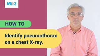 How to identify pneumothorax on a chest Xray [upl. by Betthel883]