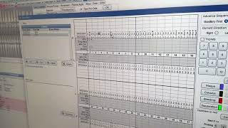 Charting Probing in a Returning Patient in Open Dental [upl. by Virendra]