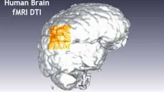 Human Brain Magnetic Resonance  Diffusion Tensor Imaging [upl. by Eiznyl270]