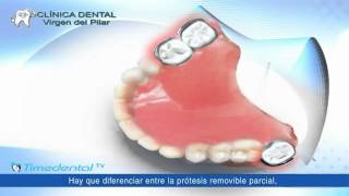 ¿Qué es una prótesis dental removible por Clínica Dental Virgen del Pilar [upl. by Olegnaed75]