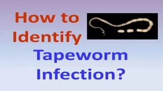 How to identify tapeworm infection [upl. by Meekyh]