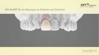 BioHPP SKY elegance  individuelle CrownAbutments Workflow German [upl. by Elwina223]