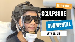 Sculpsure Submental Double Chin Results  San Antonio TX  Sculpt Away [upl. by Stanislaw464]