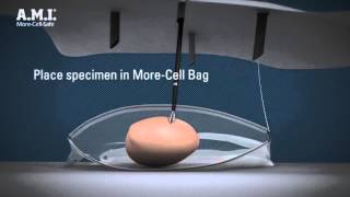 Contained power morcellation in a bag with AMI MoreCellSafe – 3D animated video [upl. by Sorel280]