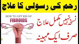 How To Treat Fibroids  Reham Mein Rasoli Ka Ilaj UrduHindi  Fibroids in UterusFibroids Ultrasound [upl. by Longwood229]