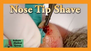 Nose Shave Biopsy Results in a Brown Noser  Auburn Medical Group [upl. by Jeralee]