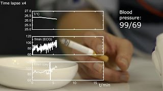 Temperature heart rate and blood pressure while smoking a cigarette [upl. by Enawd]